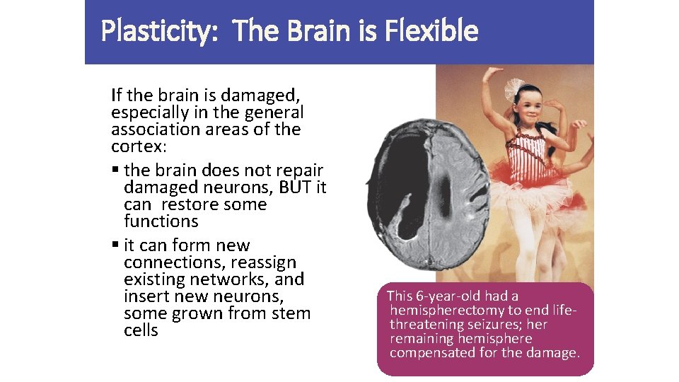 Plasticity: The Brain is Flexible If the brain is damaged, especially in the general