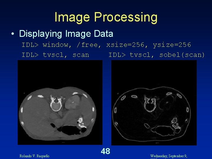 Image Processing • Displaying Image Data IDL> window, /free, xsize=256, ysize=256 IDL> tvscl, scan