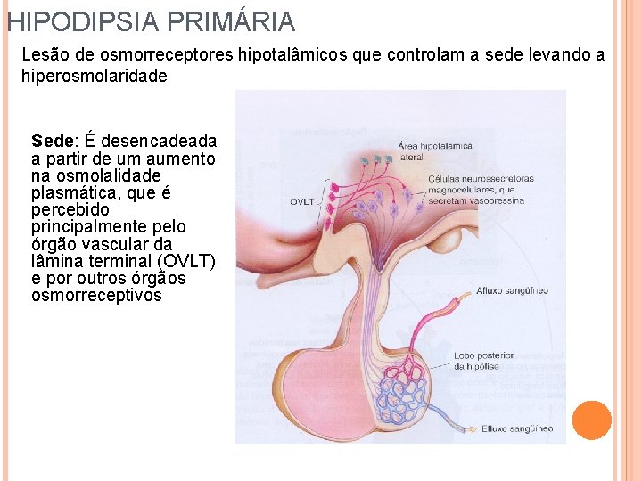 HIPODIPSIA PRIMÁRIA Lesão de osmorreceptores hipotalâmicos que controlam a sede levando a hiperosmolaridade Sede: