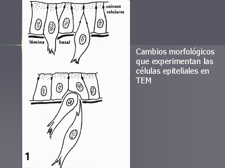 Cambios morfológicos que experimentan las células epiteliales en TEM 