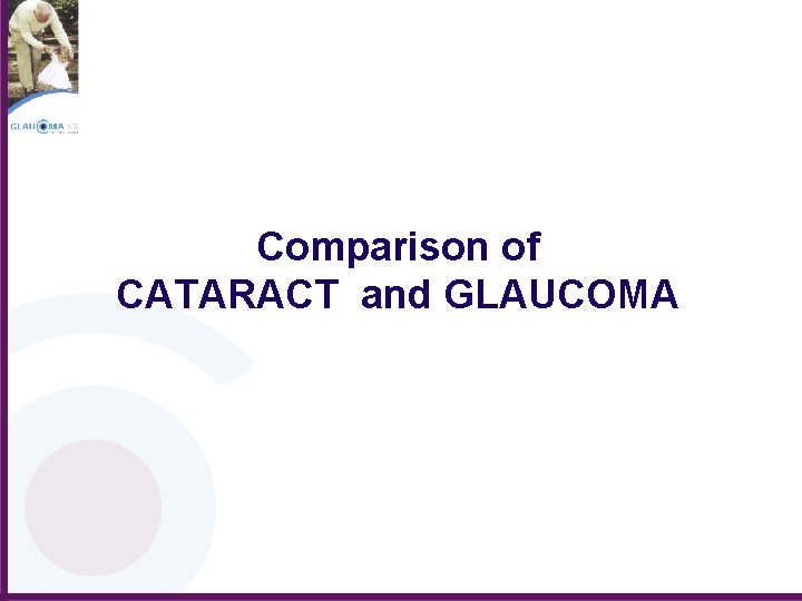 Comparison of CATARACT and GLAUCOMA 