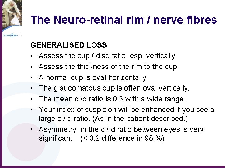 The Neuro-retinal rim / nerve fibres GENERALISED LOSS • Assess the cup / disc