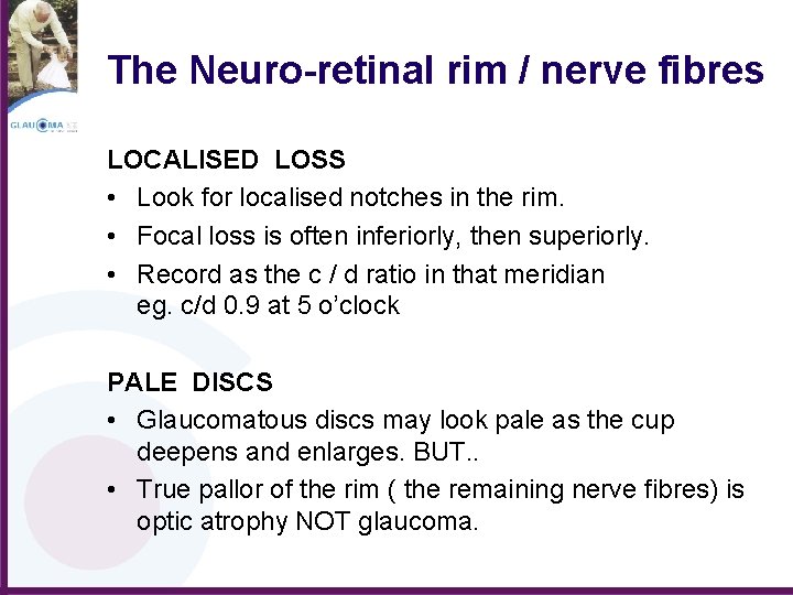 The Neuro-retinal rim / nerve fibres LOCALISED LOSS • Look for localised notches in