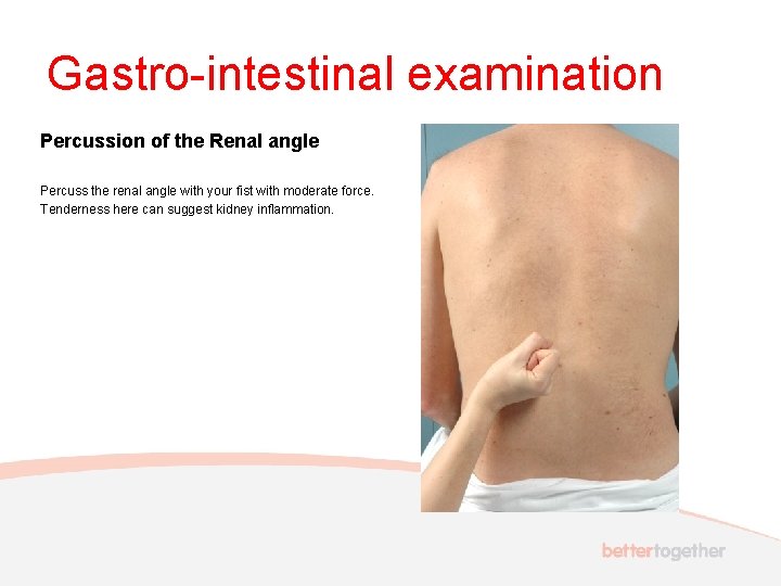 Gastro-intestinal examination Percussion of the Renal angle Percuss the renal angle with your fist