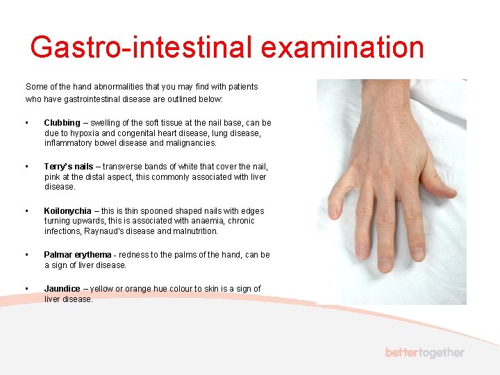 Gastro-intestinal examination Some of the hand abnormalities that you may find with patients who