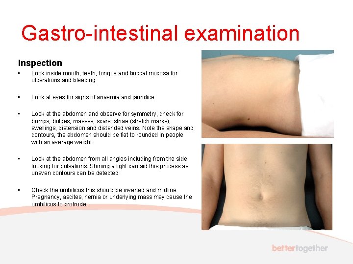 Gastro-intestinal examination Inspection • Look inside mouth, teeth, tongue and buccal mucosa for ulcerations