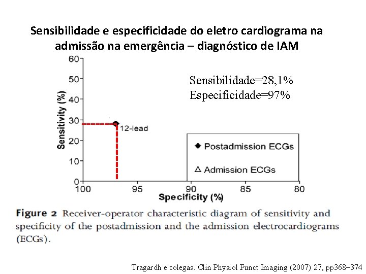 Sensibilidade e especificidade do eletro cardiograma na admissão na emergência – diagnóstico de IAM