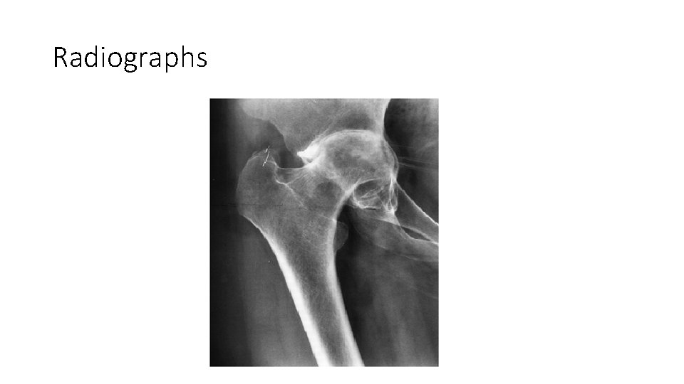 Radiographs 