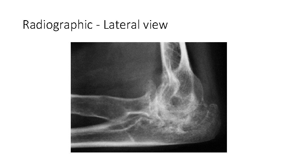 Radiographic - Lateral view 