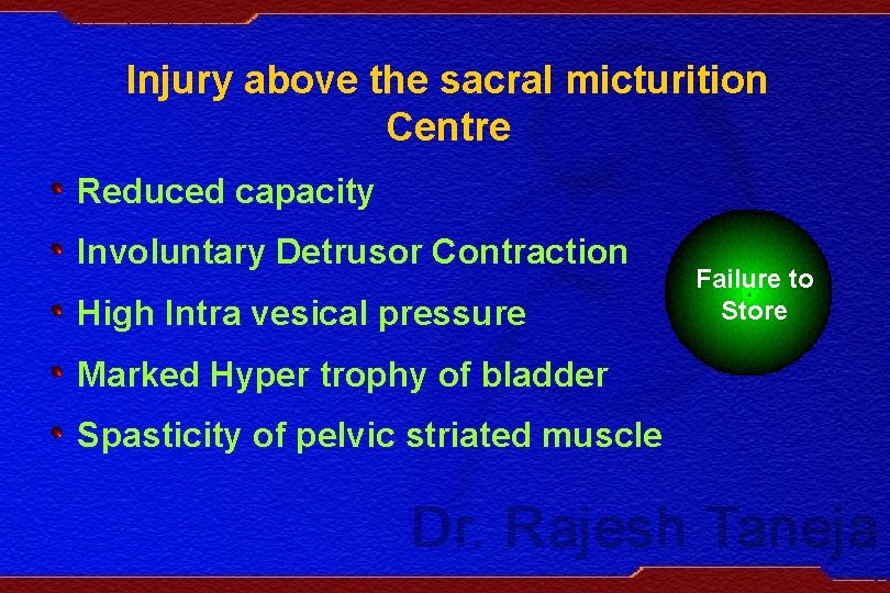 Injury above the sacral micturition Centre Reduced capacity Involuntary Detrusor Contraction High Intra vesical