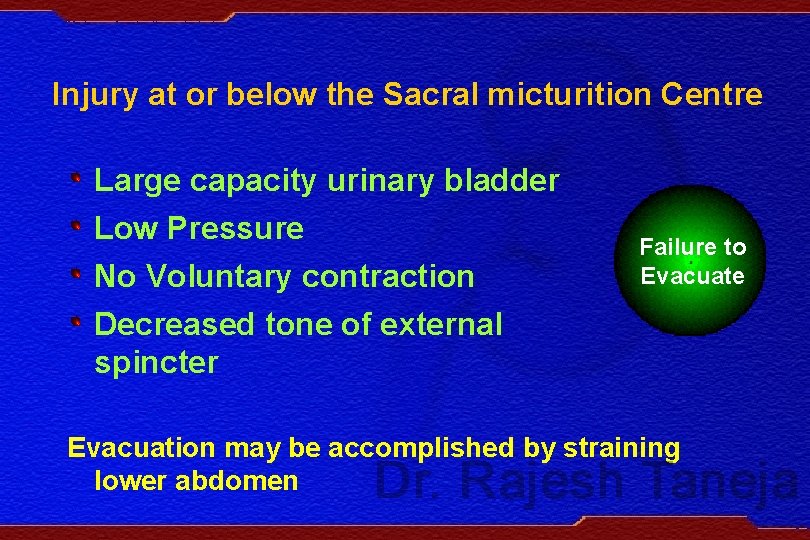 Injury at or below the Sacral micturition Centre Large capacity urinary bladder Low Pressure
