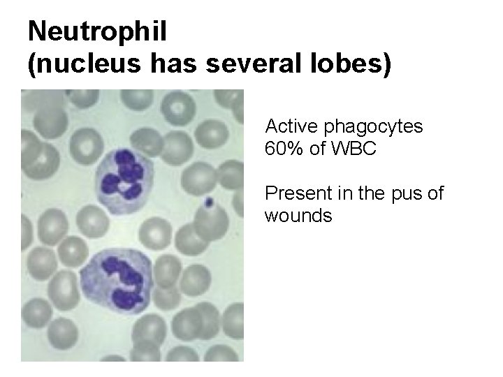 Neutrophil (nucleus has several lobes) Active phagocytes 60% of WBC Present in the pus Neutrophil (nucleus has several lobes) Active phagocytes 60% of WBC Present in the pus
