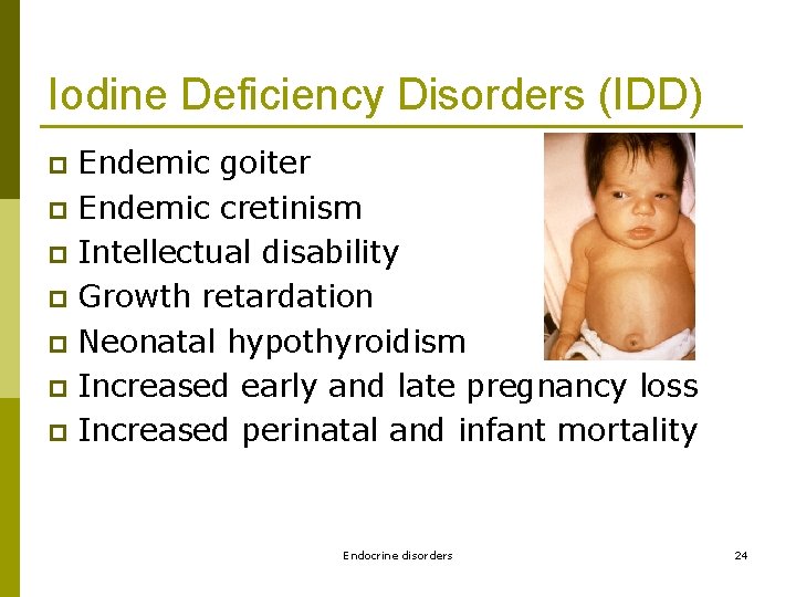 Iodine Deficiency Disorders (IDD) Endemic goiter p Endemic cretinism p Intellectual disability p Growth