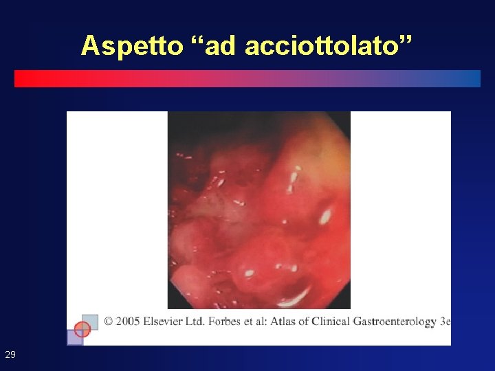 Aspetto “ad acciottolato” 29 