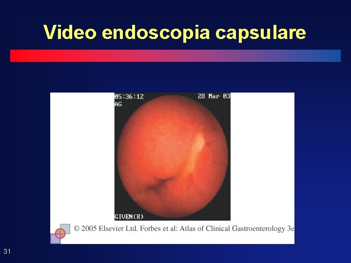 Video endoscopia capsulare 31 