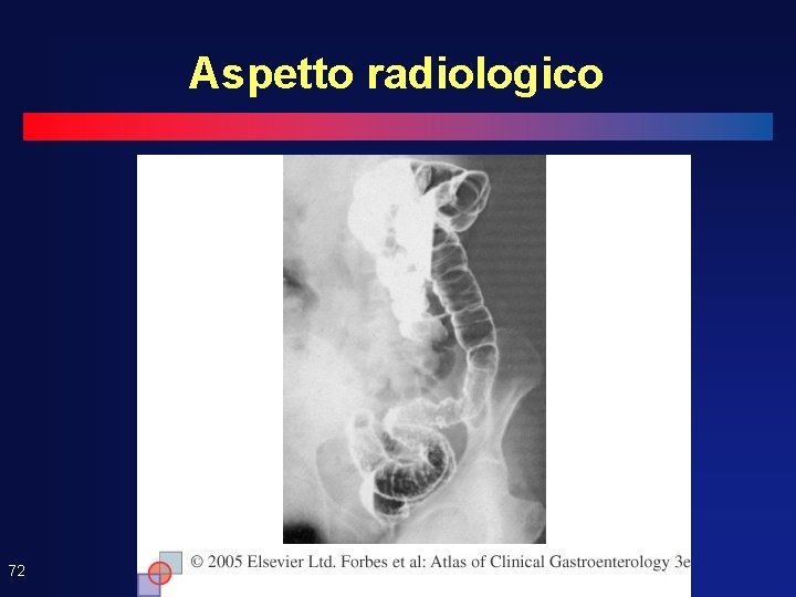 Aspetto radiologico 72 