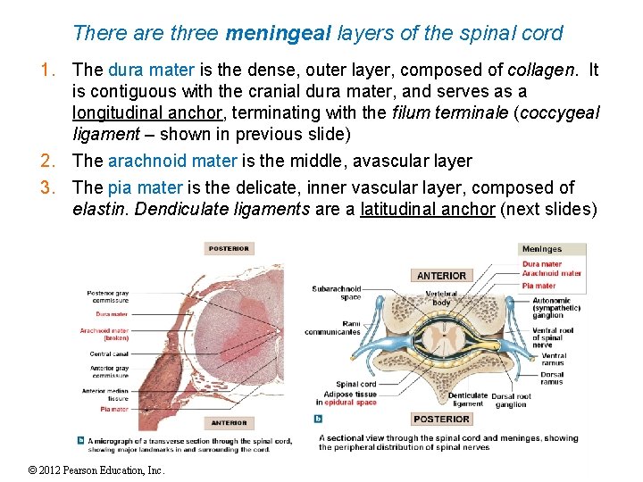 There are three meningeal layers of the spinal cord 1. The dura mater is