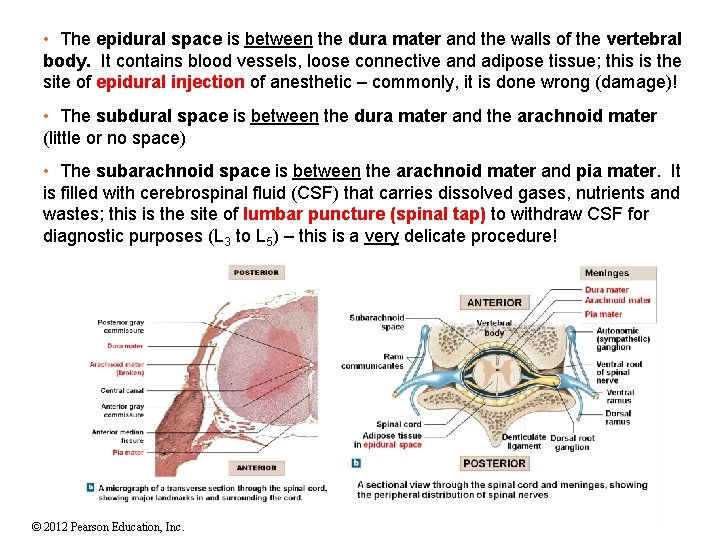 • The epidural space is between the dura mater and the walls of • The epidural space is between the dura mater and the walls of