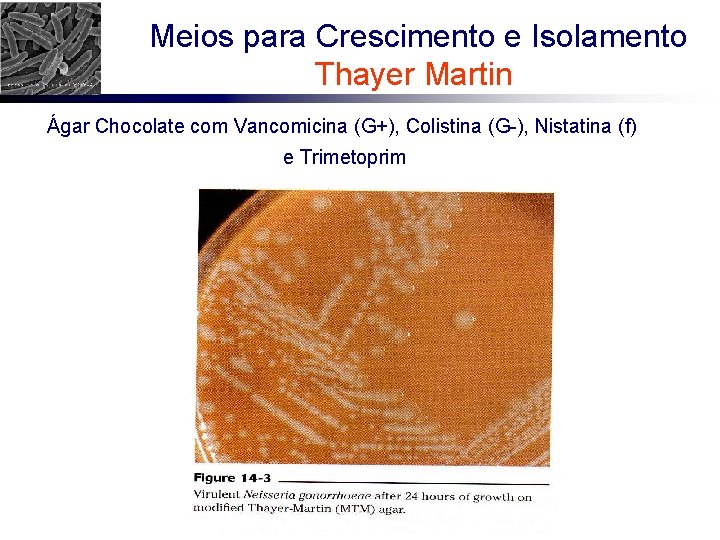  Meios para Crescimento e Isolamento Thayer Martin Ágar Chocolate com Vancomicina (G+), Colistina