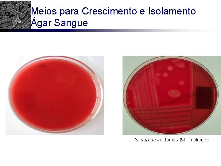 Meios para Crescimento e Isolamento Ágar Sangue S. aureus - colônias -hemolíticas 