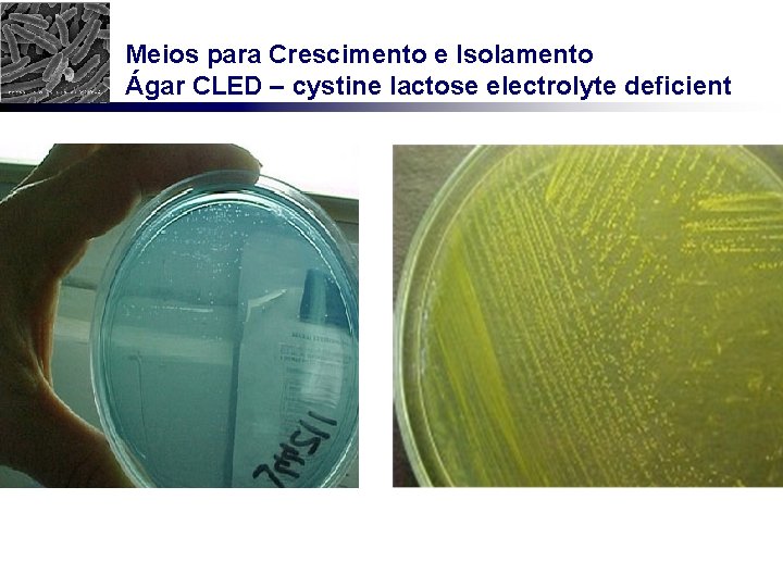 Meios para Crescimento e Isolamento Ágar CLED – cystine lactose electrolyte deficient 