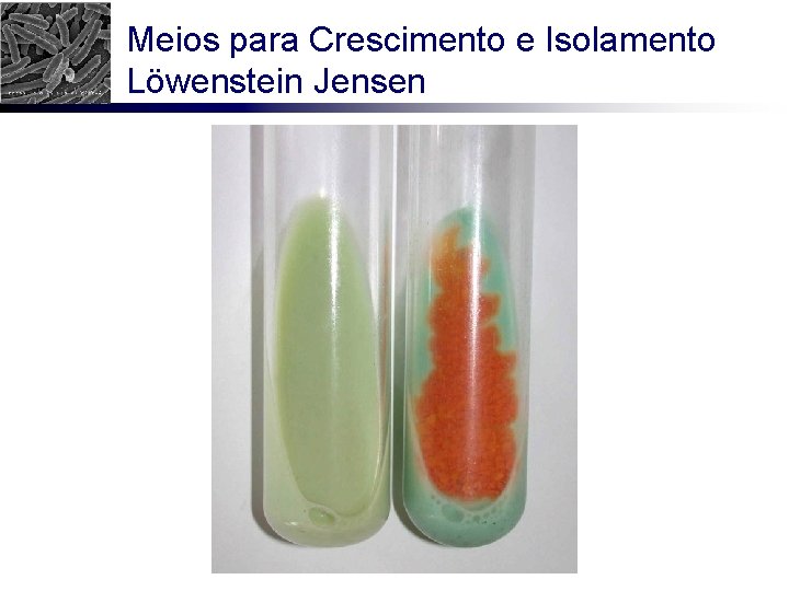 Meios para Crescimento e Isolamento Löwenstein Jensen 
