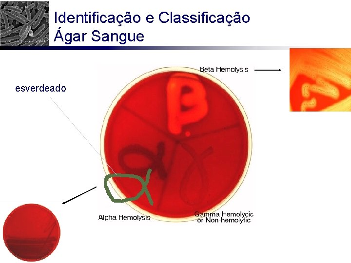 Identificação e Classificação Ágar Sangue esverdeado 