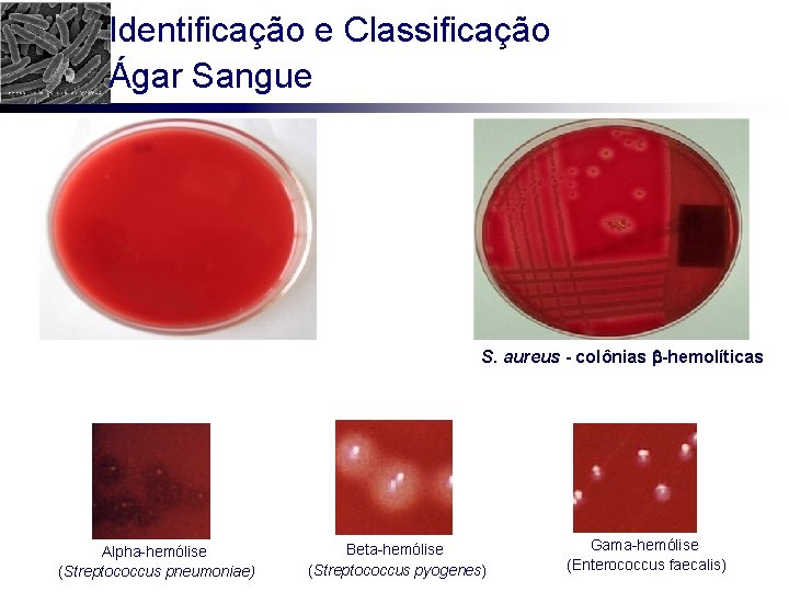 Identificação e Classificação Ágar Sangue S. aureus - colônias -hemolíticas Alpha-hemólise (Streptococcus pneumoniae) Beta-hemólise