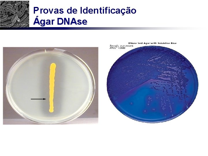 Provas de Identificação Ágar DNAse 
