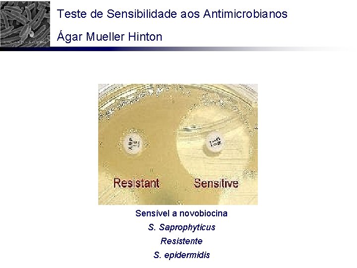 Teste de Sensibilidade aos Antimicrobianos Ágar Mueller Hinton Sensível a novobiocina S. Saprophyticus Resistente