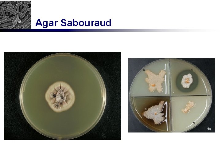 Agar Sabouraud 