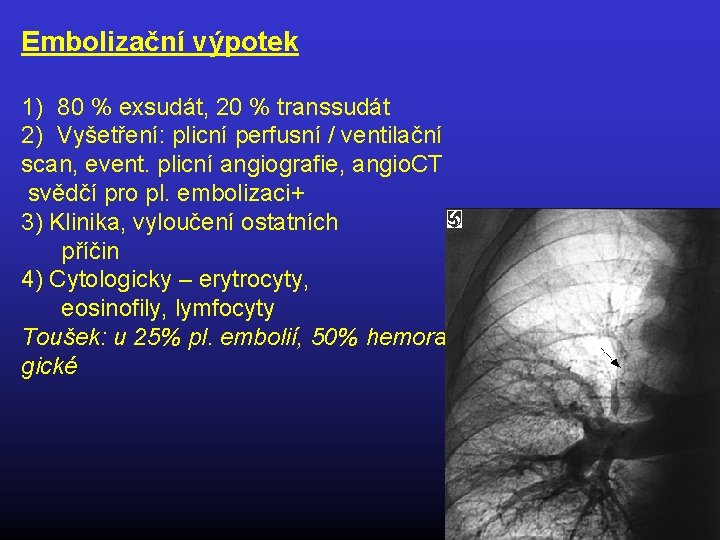 Embolizační výpotek 1) 80 % exsudát, 20 % transsudát 2) Vyšetření: plicní perfusní /