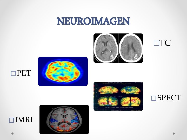 NEUROIMAGEN �TC �PET �SPECT �f. MRI 