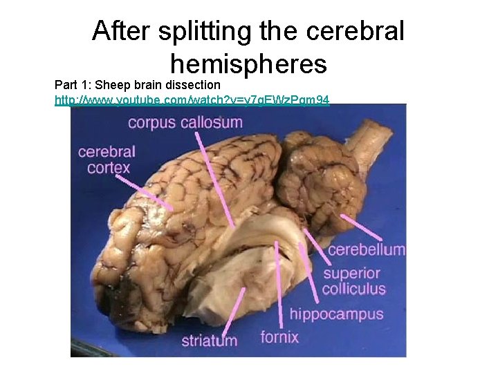 After splitting the cerebral hemispheres Part 1: Sheep brain dissection http: //www. youtube. com/watch?