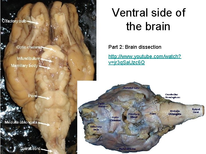 Ventral side of the brain Part 2: Brain dissection http: //www. youtube. com/watch? v=jr