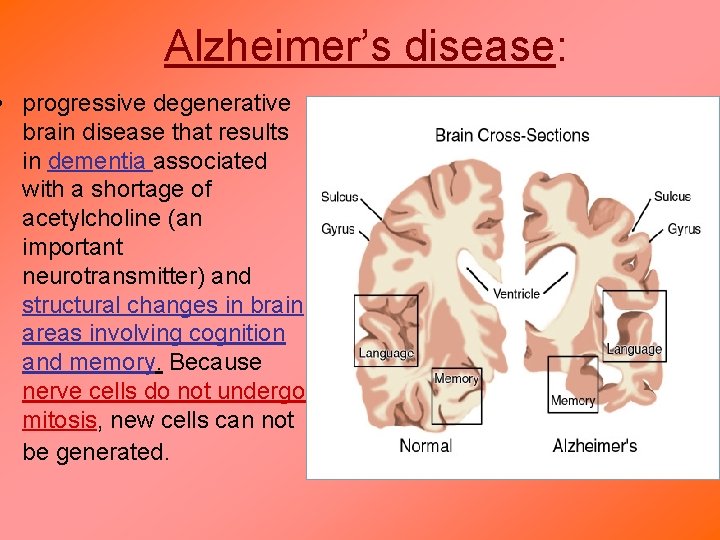 Alzheimer’s disease: • progressive degenerative brain disease that results in dementia associated with a