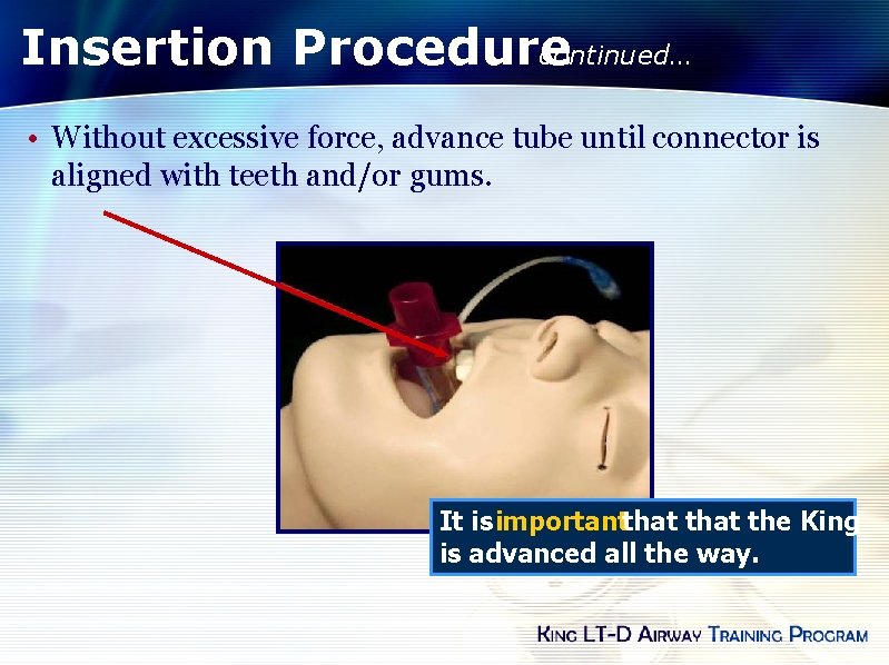 Insertion Procedure continued… • Without excessive force, advance tube until connector is aligned with