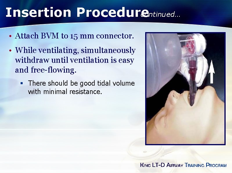 Insertion Procedure continued… • Attach BVM to 15 mm connector. • While ventilating, simultaneously