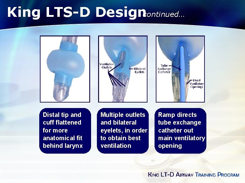 King LTS-D Designcontinued… Distal tip and cuff flattened for more anatomical fit behind larynx