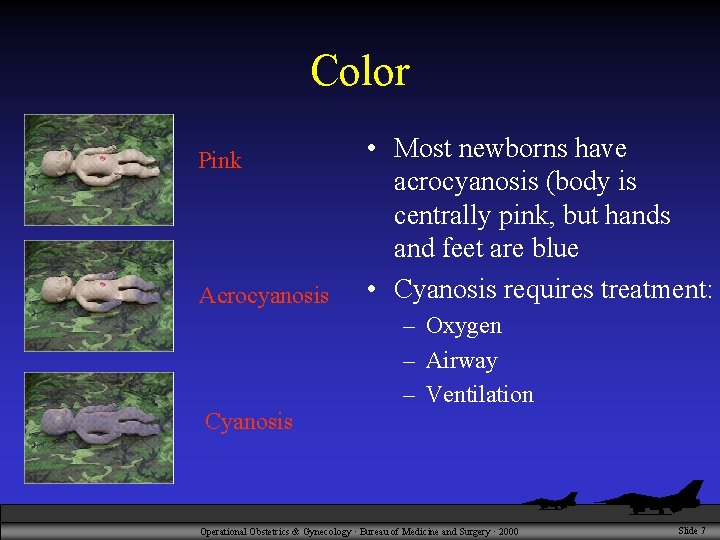 Color Pink Acrocyanosis Cyanosis • Most newborns have acrocyanosis (body is centrally pink, but