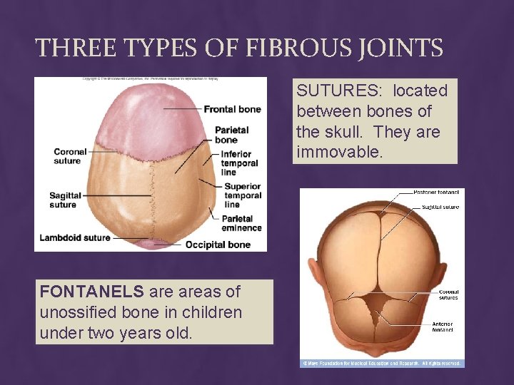 THREE TYPES OF FIBROUS JOINTS SUTURES: located between bones of the skull. They are THREE TYPES OF FIBROUS JOINTS SUTURES: located between bones of the skull. They are