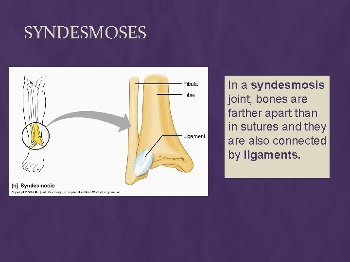 SYNDESMOSES In a syndesmosis joint, bones are farther apart than in sutures and they SYNDESMOSES In a syndesmosis joint, bones are farther apart than in sutures and they