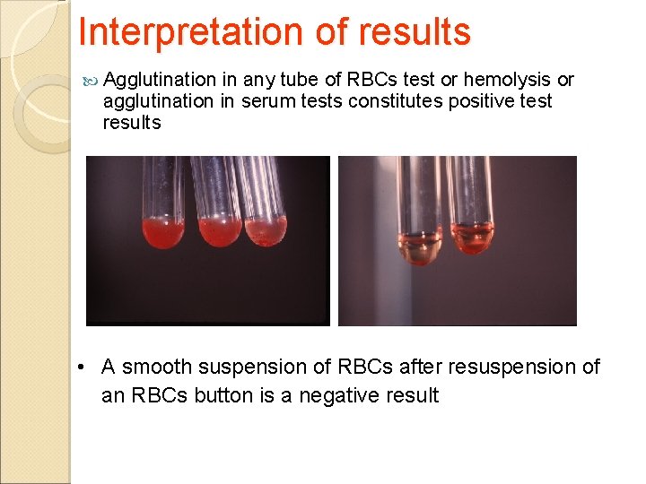 Interpretation of results Agglutination in any tube of RBCs test or hemolysis or agglutination Interpretation of results Agglutination in any tube of RBCs test or hemolysis or agglutination