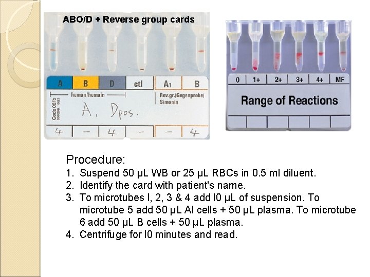 ABO/D + Reverse group cards Procedure: 1. Suspend 50 µL WB or 25 µL ABO/D + Reverse group cards Procedure: 1. Suspend 50 µL WB or 25 µL