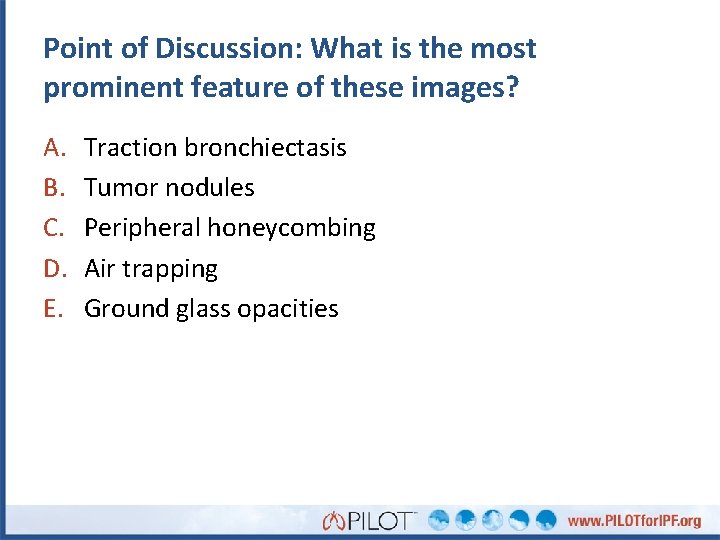 Point of Discussion: What is the most prominent feature of these images? A. B.