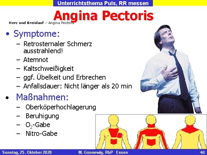 Unterrichtsthema Puls, RR messen Angina Pectoris Herz und Kreislauf – Angina Pectoris • Symptome:
