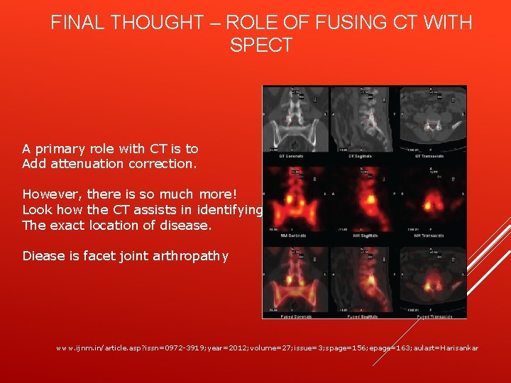 FINAL THOUGHT – ROLE OF FUSING CT WITH SPECT A primary role with CT