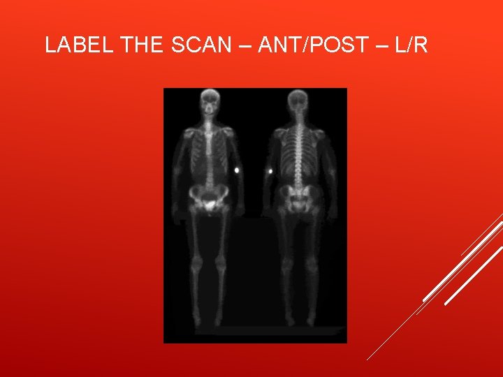 LABEL THE SCAN – ANT/POST – L/R 