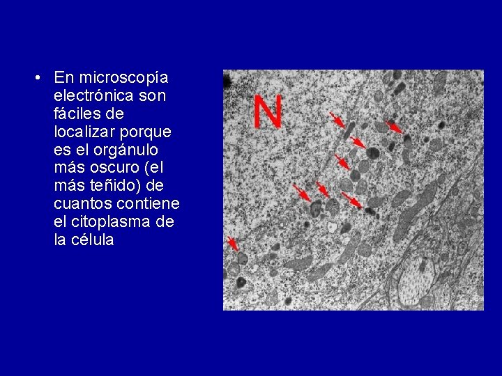  • En microscopía electrónica son fáciles de localizar porque es el orgánulo más