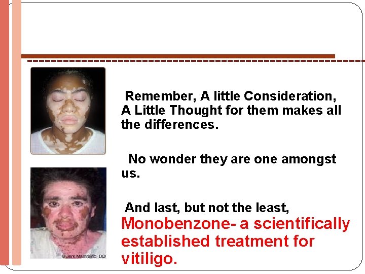 Remember, A little Consideration, A Little Thought for them makes all the differences. No